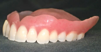 通常の義歯
